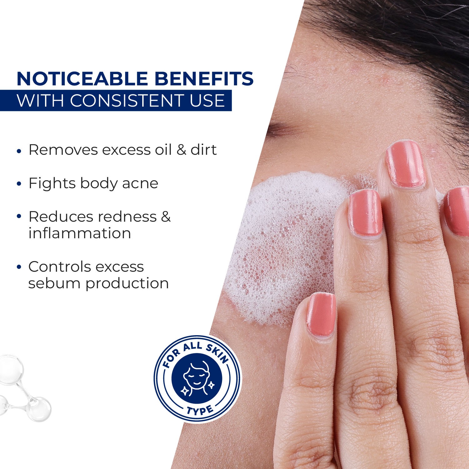 Clinsol Acne Soap 75g – Deep Cleanse for Acne & Pimple‑Prone Skin - Image 4