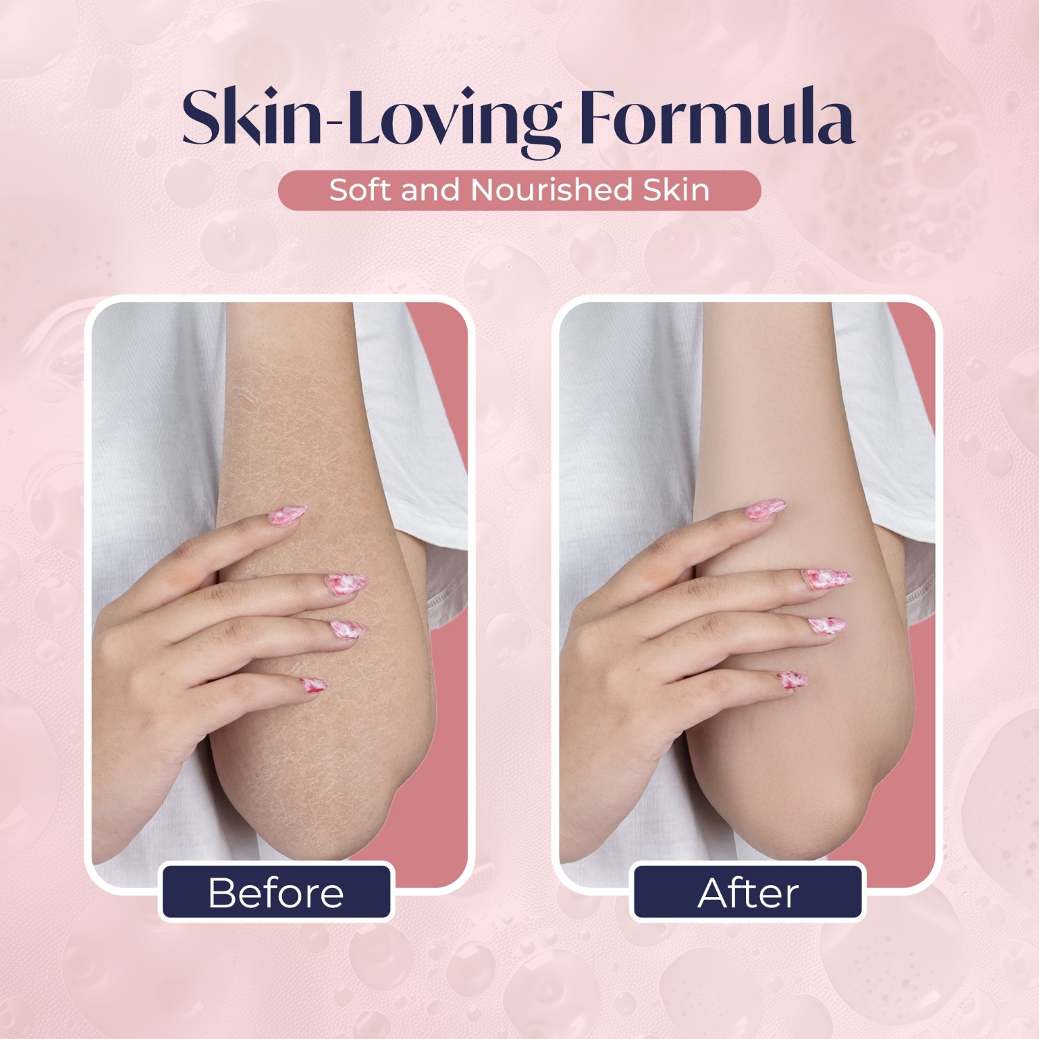 Medisoft Moisturizing Bar Soap 75g - Image 5