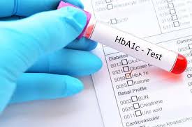 HBA1C BLOOD TEST