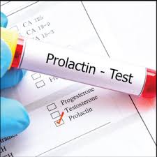 Prolactin Test